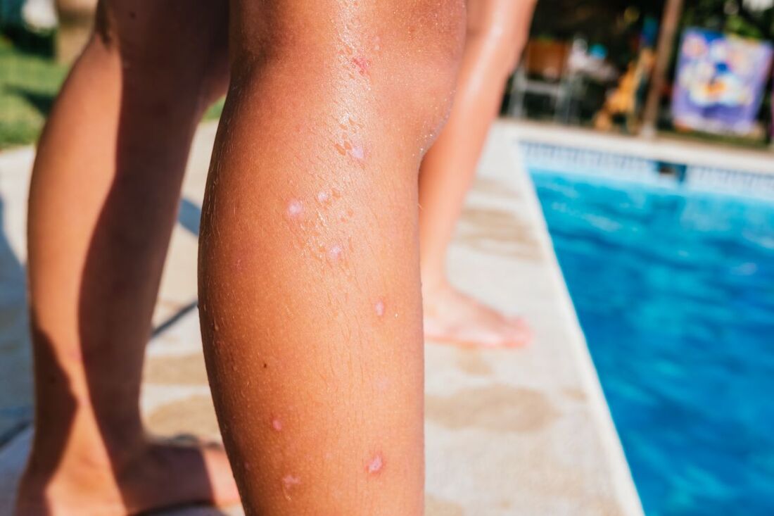 How To Keep Mosquitoes Away From Your Pool